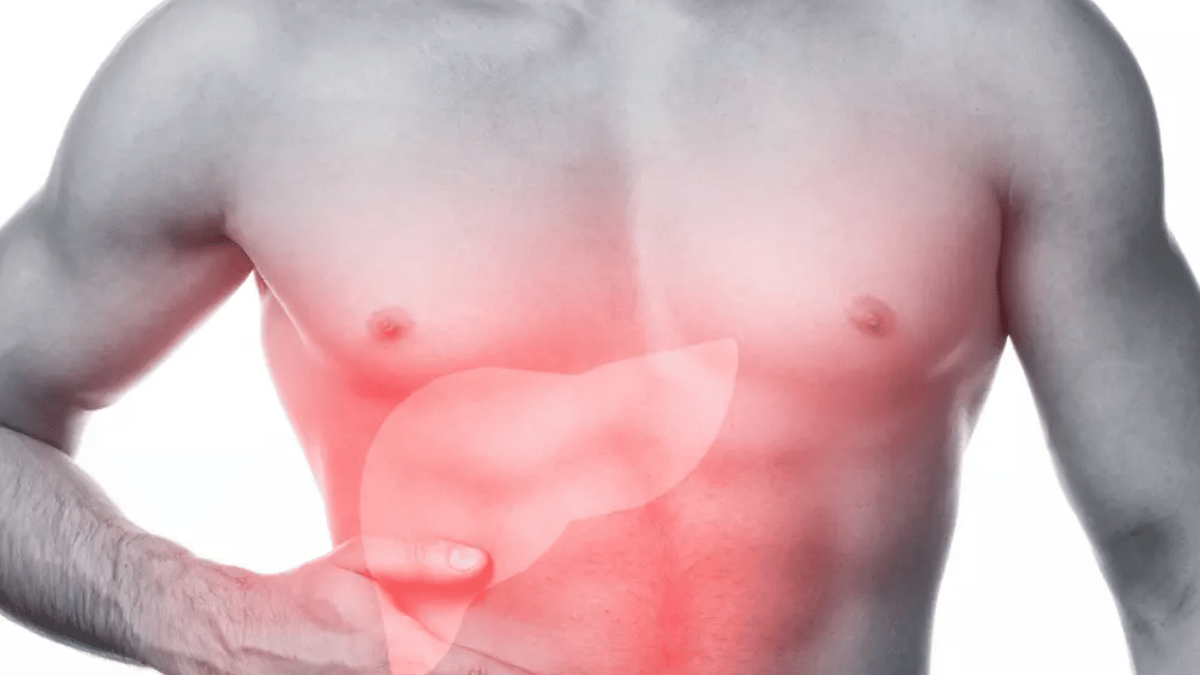 Fatty-liver-skin-warning-signs